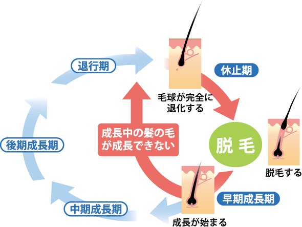 早期成長期 中期成長期 後期成長期 退行期 休止期 脱毛 成長期の髪の毛が成長できない