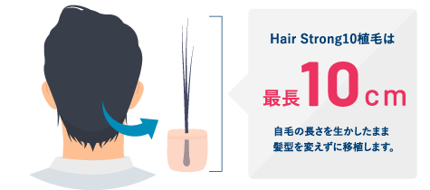 Hair Strong10植毛は最長10cm