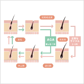 【医師監修】毛周期（ヘアサイクル）とは？AGAとの関係について