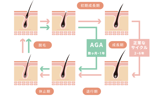 【医師監修】毛周期（ヘアサイクル）とは？AGAとの関係について