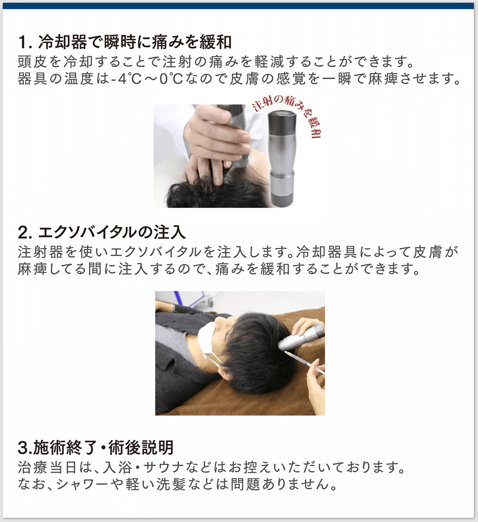 1. 冷却器で瞬時に痛みを緩和 頭皮を冷却することで注射の痛みを軽減することができます。器具の温度は-4℃～0℃なので皮膚の感覚を一瞬で麻痺させます。2. エクソバイタルの注入 注射器を使いエクソバイタルを注入します。冷却器具によって皮膚が麻痺してる間に注入するので、痛みを緩和することができます。3.施術終了・術後説明 治療当日は、入浴・サウナなどはお控えいただいております。なお、シャワーや軽い洗髪などは問題ありません。