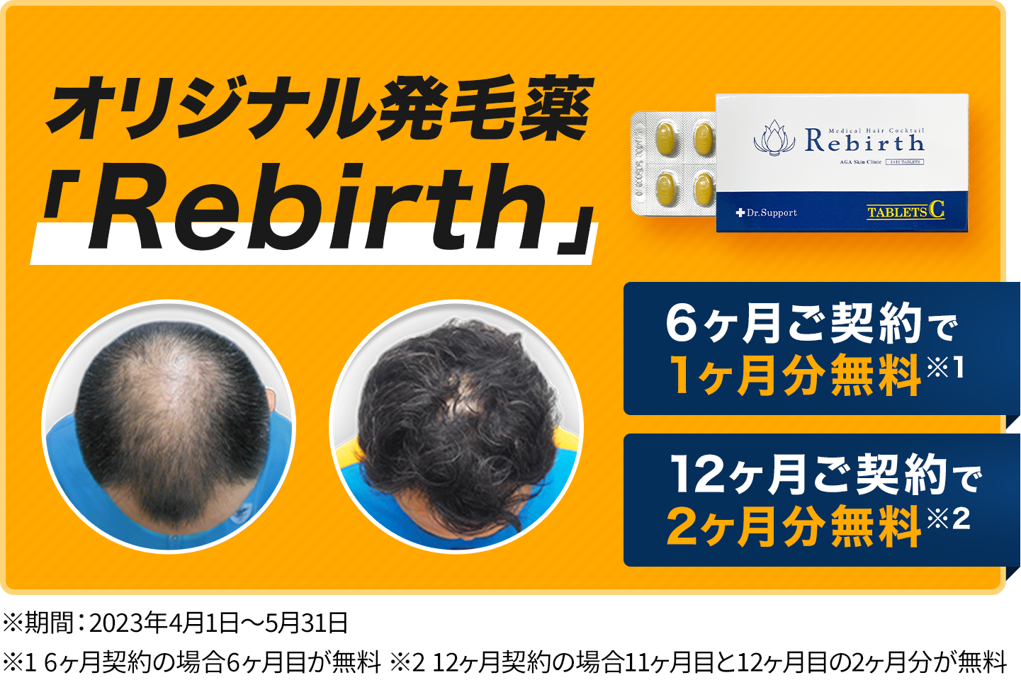 Rebirth - 当院のオリジナルAGA治療薬|【公式】薄毛・抜け毛治療なら 
