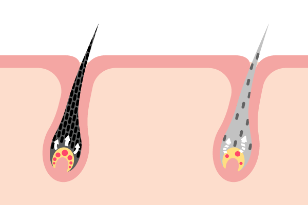 白髪のメカニズム