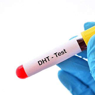 【医師監修】DHT（ジヒドロテストステロン）とは？