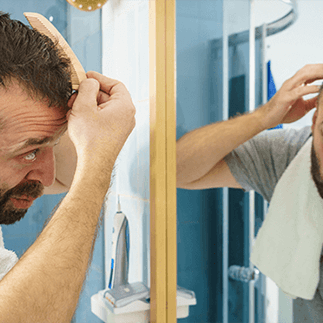 円形脱毛症の原因とは？なりやすい人の特徴や治す方法について解説