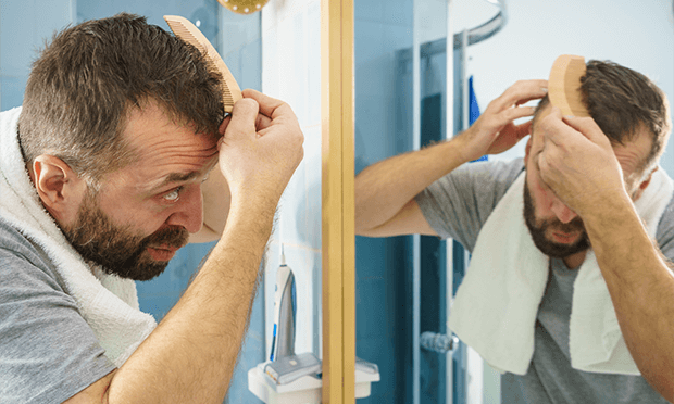 薄毛の原因とは？対策するべきことや症状について解説