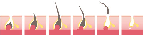 毛根を再生させるには